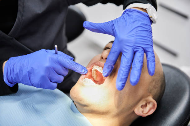 Best Broken or Cracked Tooth Emergency Dentist in Westminster, TX